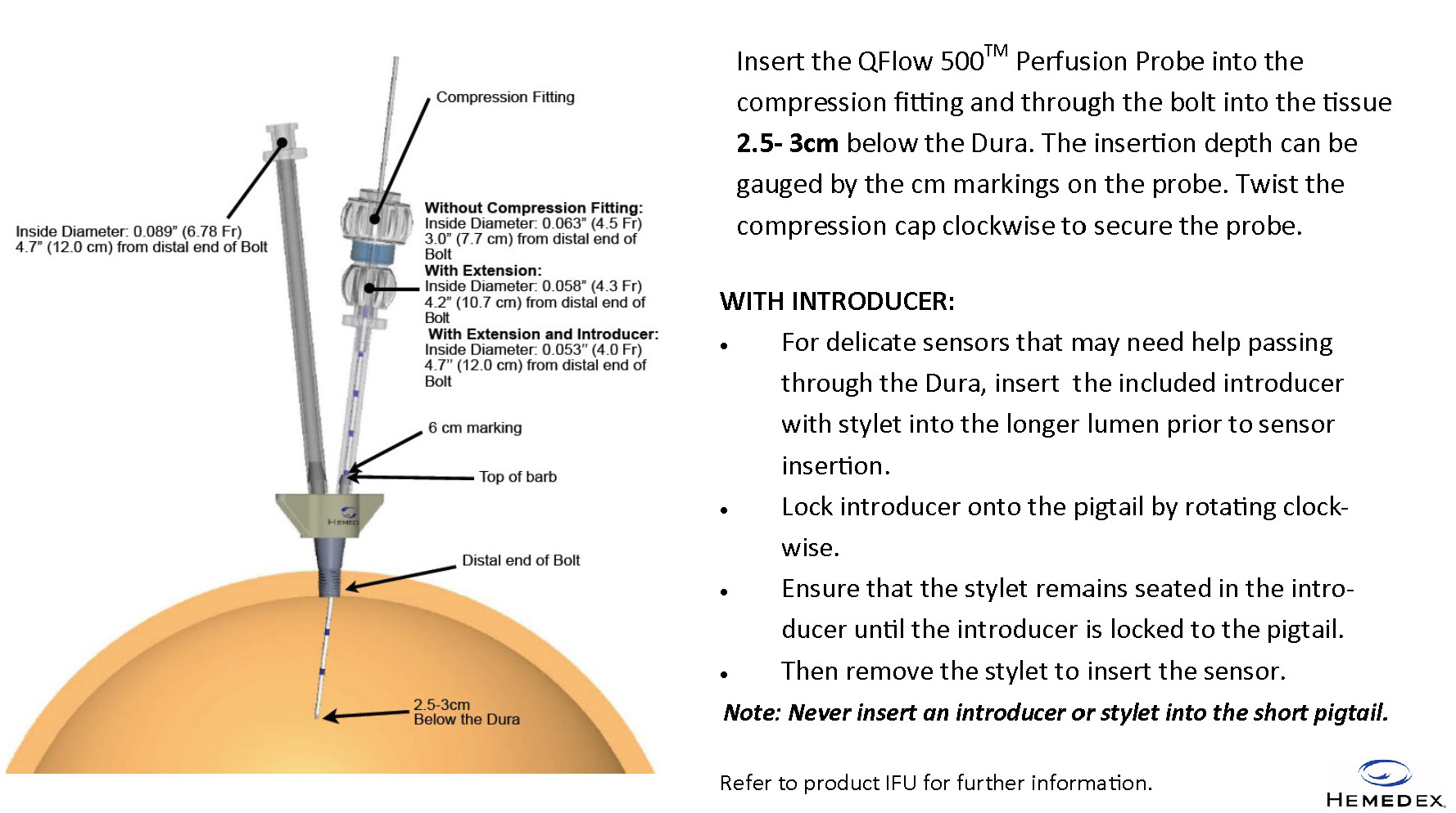 Dual Lumen Bolt placement guide diagram